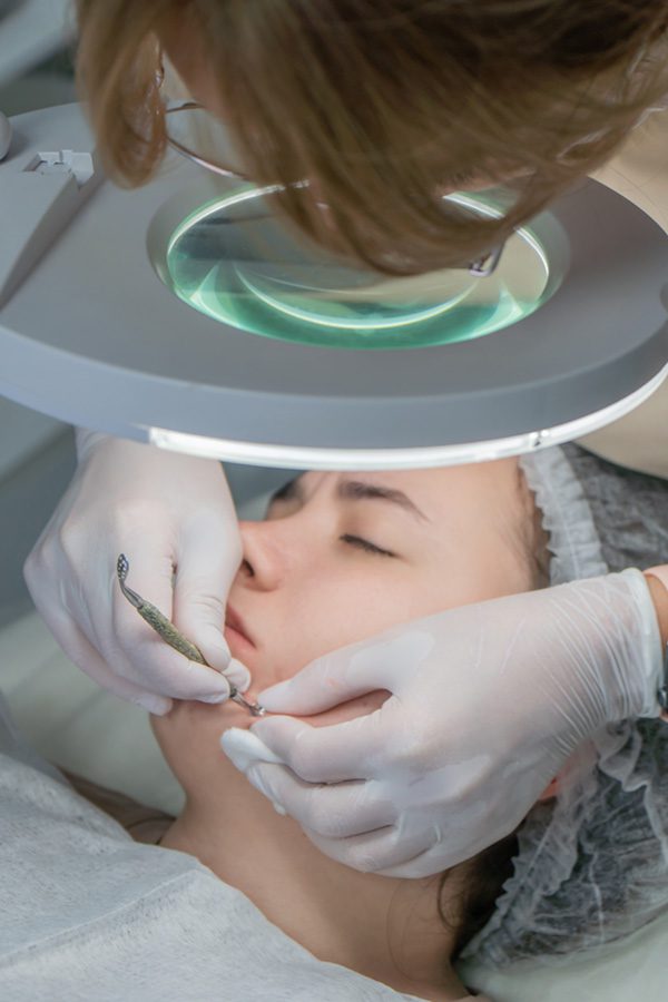 180_wellness_dermaplaning