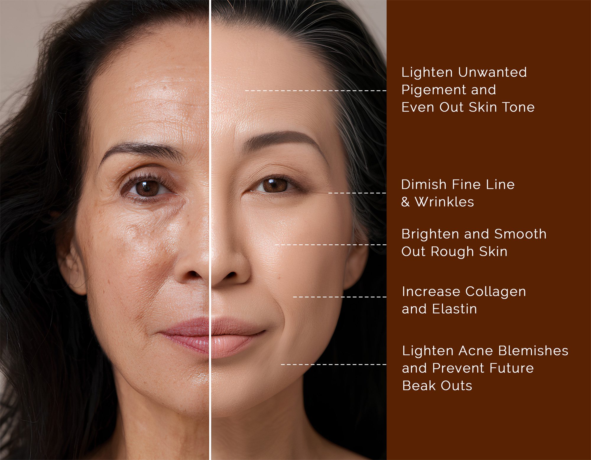 Microneedling-180-wellness-north-dallas-2